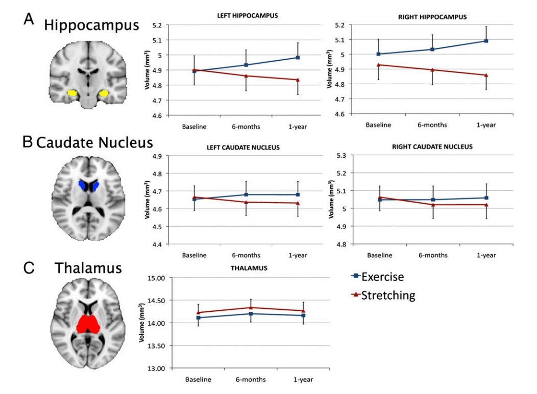 calotonterias's tweet photo. El ejercicio literalmente aumenta el tamaño de tu cerebro.

Este ensayo controlado aleatorizado con adultos mayores mostró que el ejercicio aeróbico aumenta el volumen del hipocampo; y además este aumento se asoció a mayores niveles de BDNF y a mejoras en la memoria espacial. https://t.co/FMRhof0Uw5