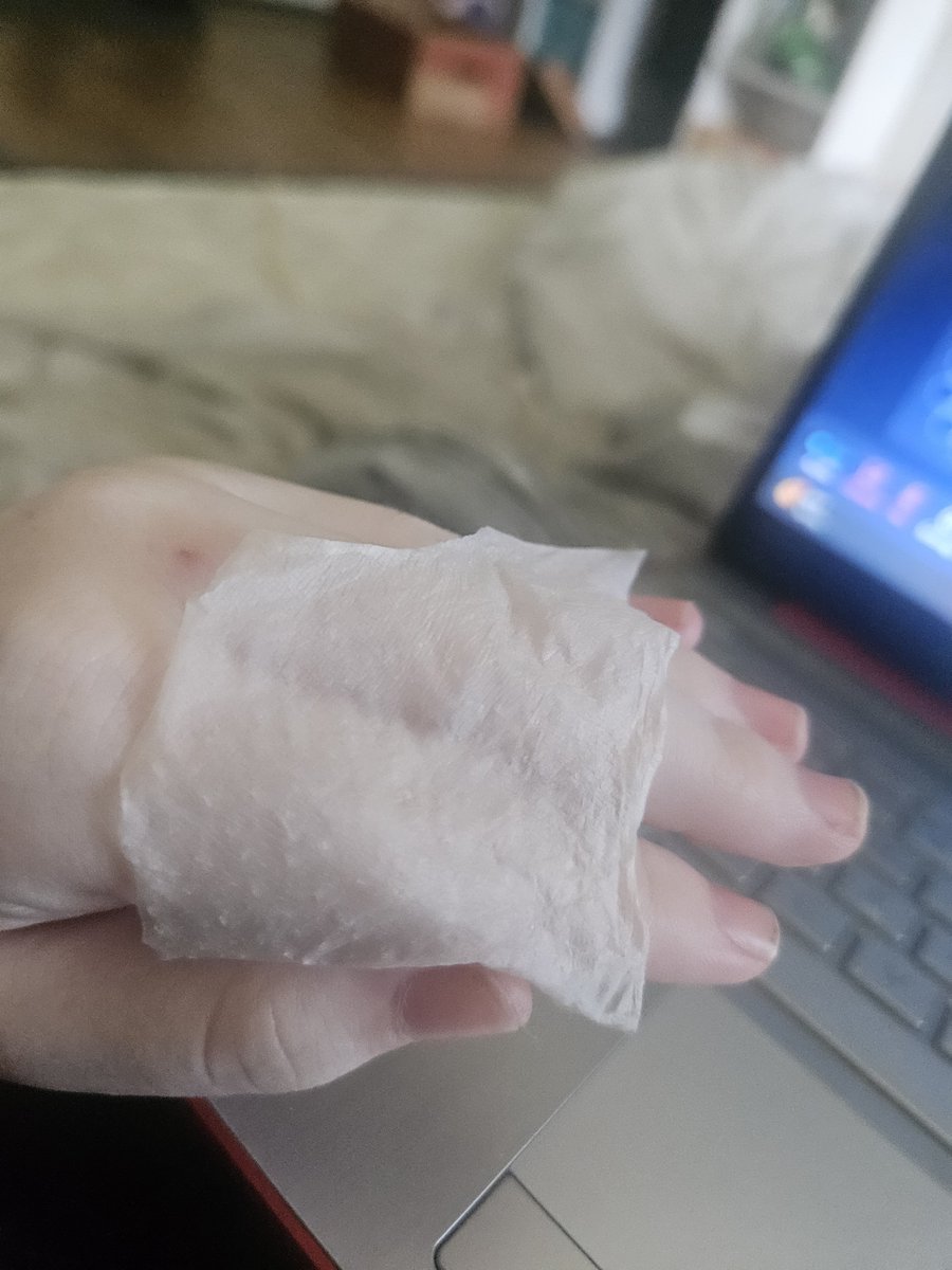 KitsAndBlood's tweet photo. Ethically sourced human skin. My sister had a sunburn https://t.co/3H3uvXB5kc