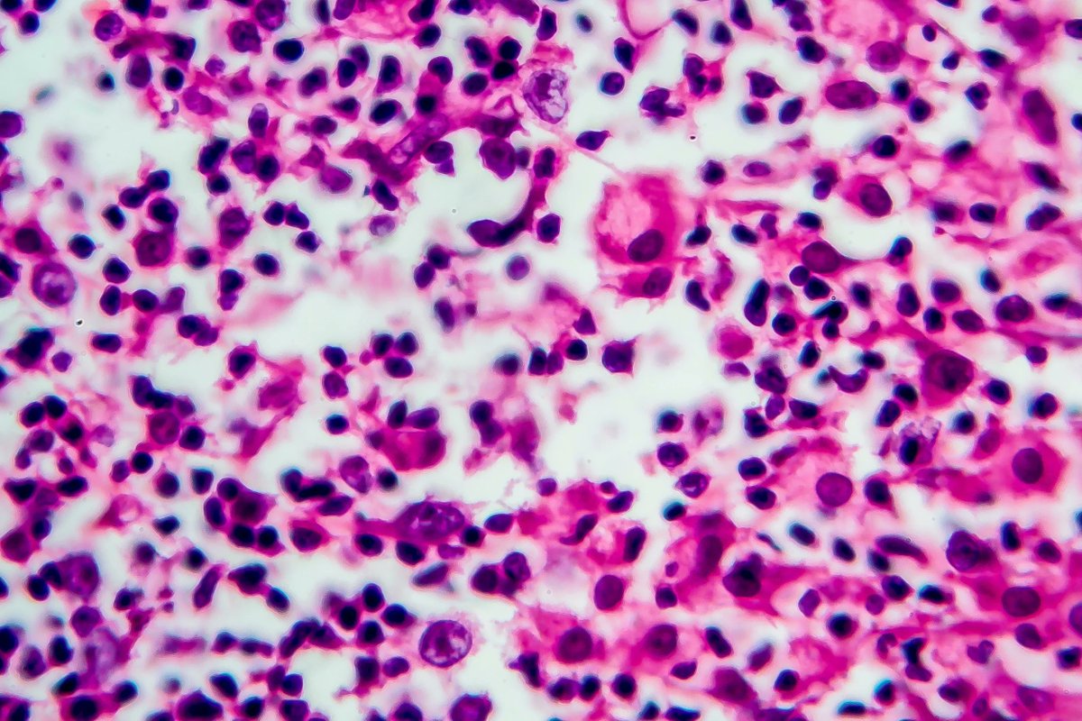 cirnosad's tweet photo. Believe it or not but we're basically a macro-species, as individuals. We just don't see it at our scale.

We're a "murmuration" of 30-40 trillion cells and we're the aggregation of them together.

Actually life and consciousness is scale free phenomenon, but that's a subject for another time.
