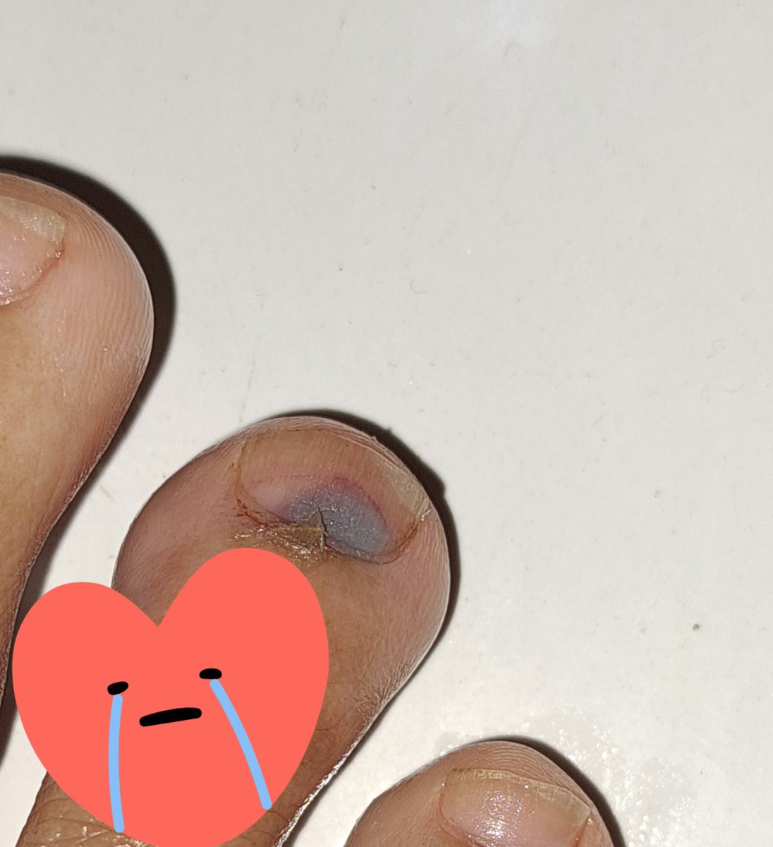 zynjasminne's tweet photo. Day 1 kejatuhan batu timbangan ukuran sekilo 😭 ada ada aja cobaan hidup 🫠 https://t.co/xToGT8766K