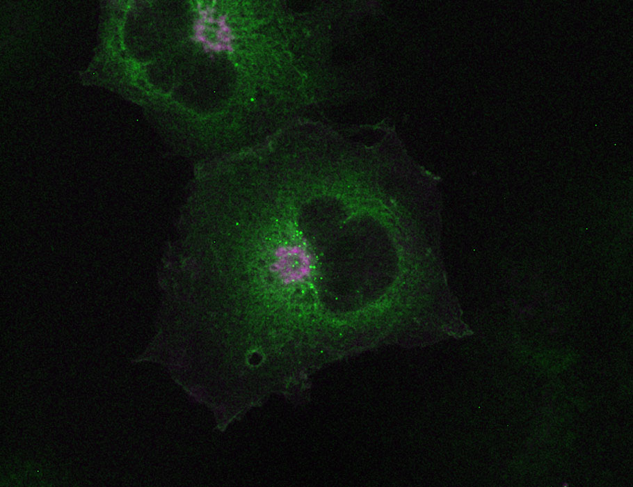 SciImmunology's tweet photo. A new Science #Immunology study characterizes 265 mutations found in patients with familial Mediterranean fever, providing insight into how #CDC42 variants can enhance #pyrin and inflammasome activation during autoimmune disorders. https://t.co/jQiPXlSvlr https://t.co/FEDpjgfG31