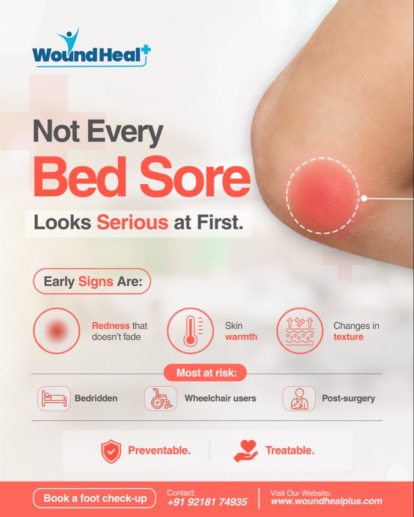 WoundHealPlus's tweet photo. Pressure ulcers can worsen fast when early signs are missed. 

Watch for redness that doesn't fade, warmth, or a change in skin texture over a pressure point. 

Preventable. Treatable. Never inevitable. 
WoundHeal+, we treat every wound differently.

#PressureUlcers #BedSores https://t.co/98BLbZv2dd