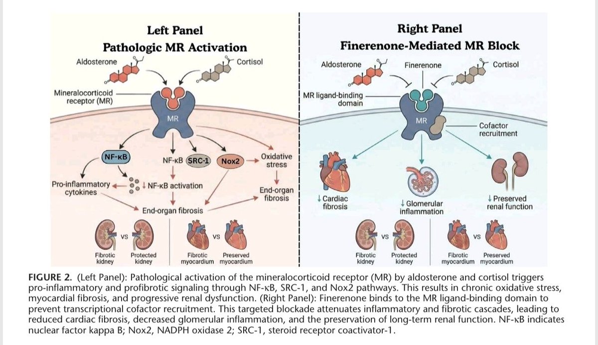 mrcsgmb84's tweet photo. Revisión sobre el antagonismo del receptor mineralocorticoide (RM) con finerenona en el continuum cardiorrenal. Un análisis detallado de su farmacodinamia, evidencia pivotal (DM2, ERC, ICFEVImr/ICEFEVIp) y posicionamiento terapéutico. 🧵 👇
@SENefrologia @SLANH_ @redGDPS @Diabetes_SEMI @IcyfaSemi @ICardiacaSEC @PerlaZambrano @JonathanNefro @gonzaeperez