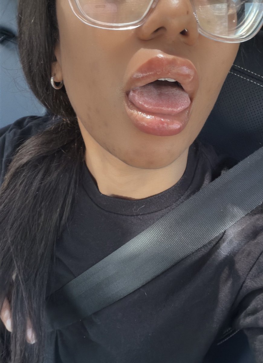 jasabelleroseox's tweet photo. i got a little filler and now all i can think about is how good these juicy lips would look wrapped around something 🖤🤭 https://t.co/zsybW5tRXo