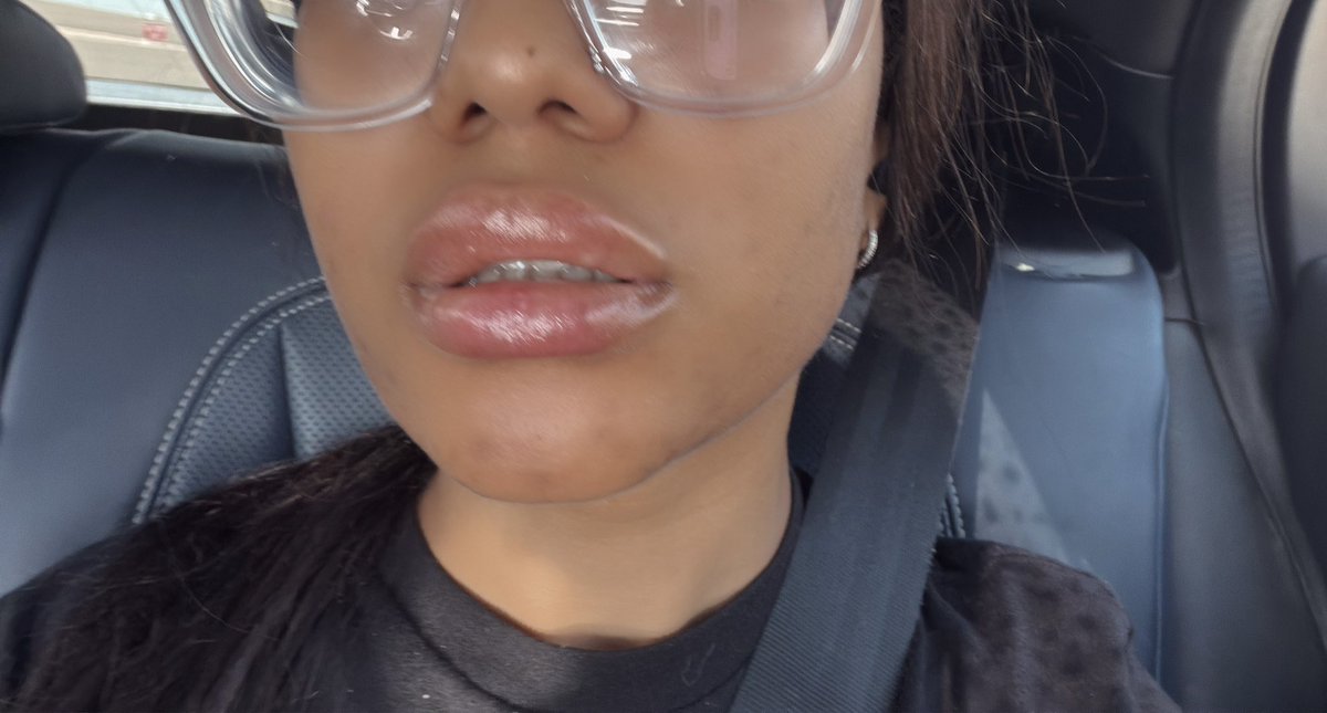 jasabelleroseox's tweet photo. i got a little filler and now all i can think about is how good these juicy lips would look wrapped around something 🖤🤭 https://t.co/zsybW5tRXo