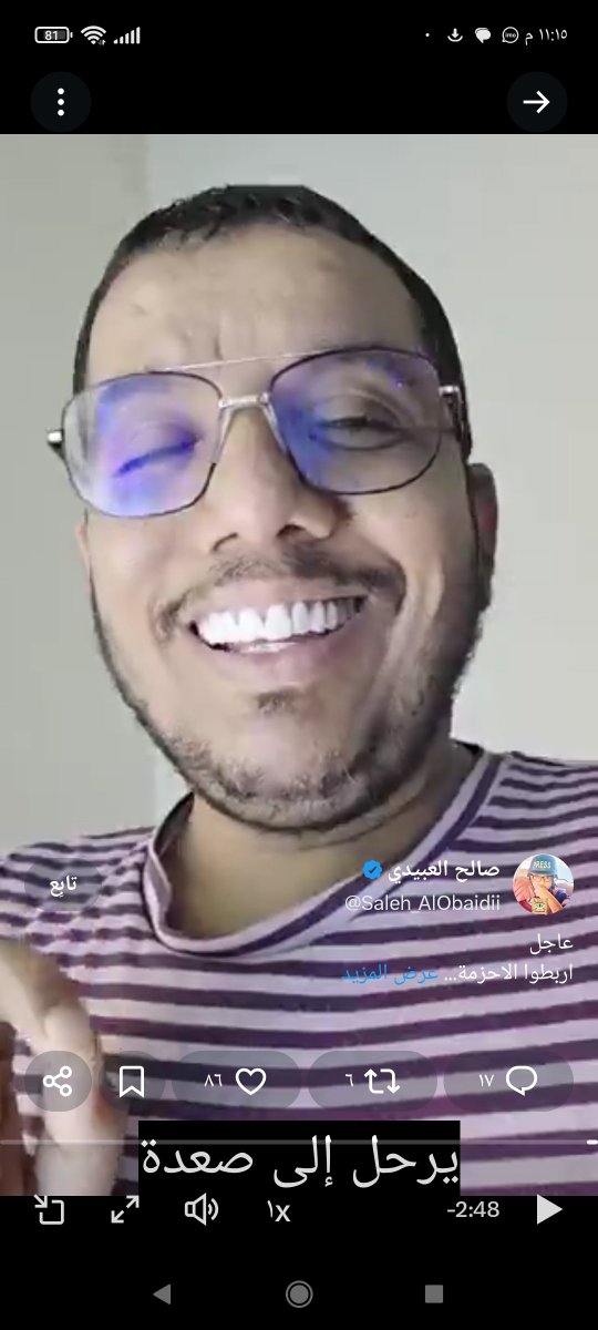 SalehMwra's tweet photo. @Saleh_AlObaidii الناس حاسدين لك على سنونك 
حتى اولادك لاتكون تصورهم من شان مايحسدوهم برضه اسنانهم حلوه ماشاء الله تبارك الله https://t.co/bVRDdktUzt