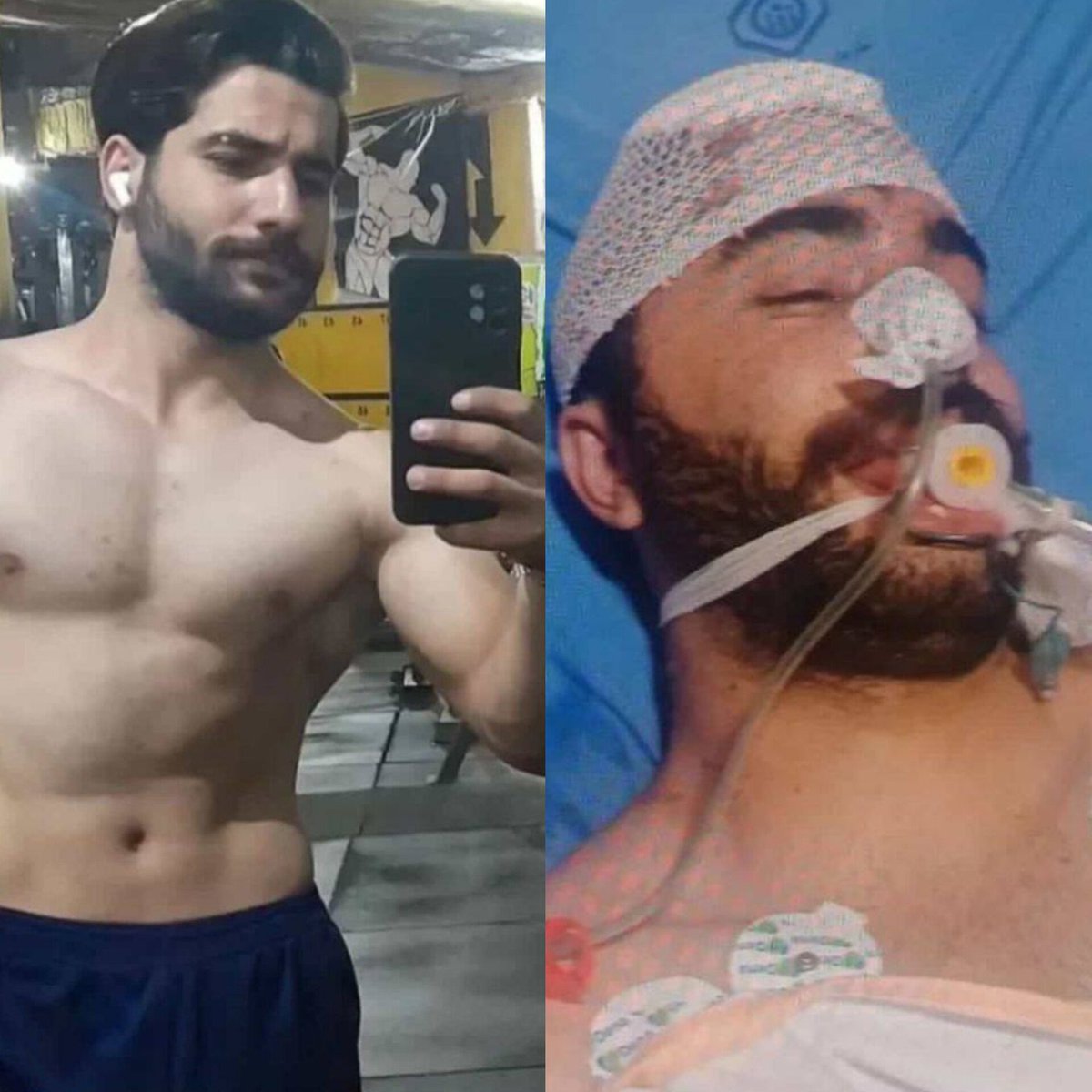 IranNewsAgency0's tweet photo. 🚨Don’t stop talking about Iran.
A son of Iran who gave his life for his homeland, Mehdi Salehi Bakhtiari was only 23 years old, from Yazdanshahr, Isfahan.

He was shot with pellets in the head and neck by forces of the Islamic Republic terrorist regime.

For 50 agonizing days, Mehdi fought for his life.

Fifty days of pain.

Fifty days of suffering.

Fifty days in which his family held onto hope that their young son would survive.

On February 26, 2026, his body could fight no longer. Mehdi died in the hospital from his wounds.

He was only 23.

He should have had decades ahead of him.

Instead, his family watched him suffer for 50 days because the regime answered Iran's young generation with gunfire.

And this is the same Islamic Republic terrorist regime that massacred more than 40,000 Iranians in just two days.

More than 40,000 innocent people slaughtered while demanding freedom, dignity, and a future free from tyranny.

Say his name.

Mehdi Salehi Bakhtiari.

A son of Iran.

Never forgotten.