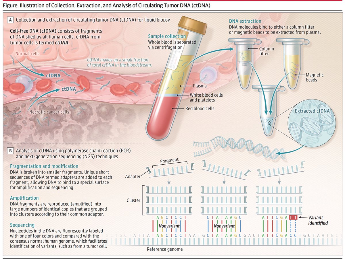 EricTopol's tweet photo. A new review of the evidence for use of cell-free tumor DNA (liquid biopsy) in patients with cancer. It does not include screening for cancer @JAMA_current 
https://t.co/UpXUTOP1cl https://t.co/QUR3i8erSZ