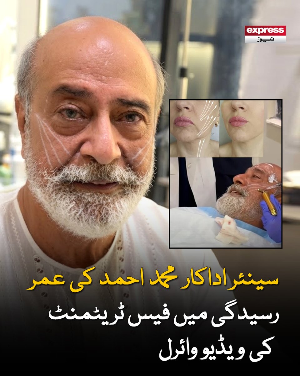 Roznama_Express's tweet photo. بعض افراد کا کہنا ہے کہ قدرتی عمر رسیدگی کی اپنی خوبصورتی اور وقار ہوتا ہے
مزید پڑھیں : https://t.co/OwPU5CgQXQ
#ExpressNews #MuhammadAhmed #ViralVideo #Entertainment https://t.co/sffTIcbwYT