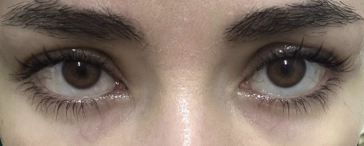 suzydacookie's tweet photo. حوار اني باخد السيرم ببلاش كل مرة هو اللي مجنون شوية بصراحة 😩 و بصوا نتيجته عليا تحفة ازاي https://t.co/gIm8UtqKqU