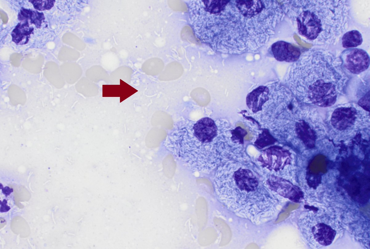 CUHemepath's tweet photo. Hint: Don't forget to look outside of the cells. https://t.co/52cPiZYlNf