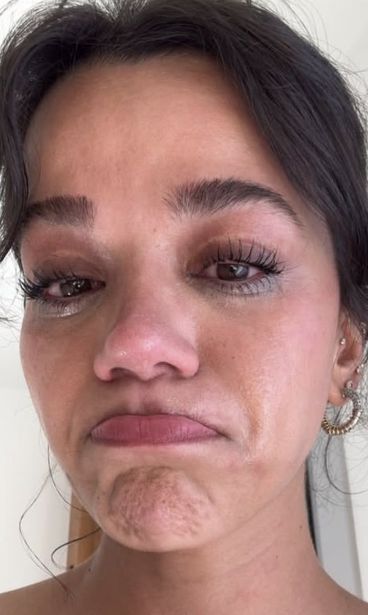 XepaGossip's tweet photo. Quando acho que ela chegou ao fundo do poço, ela cava mais um pouco. 😂
Essa foto é a prova de que falta de vergonha na cara também pode ser um estilo de vida.
Pelo amor de Deus, quem olha para uma foto dessas e pensa: “vou postar”? 
Deve estar querendo intimidar o #KeremBürsin. https://t.co/djKx3eQDKd