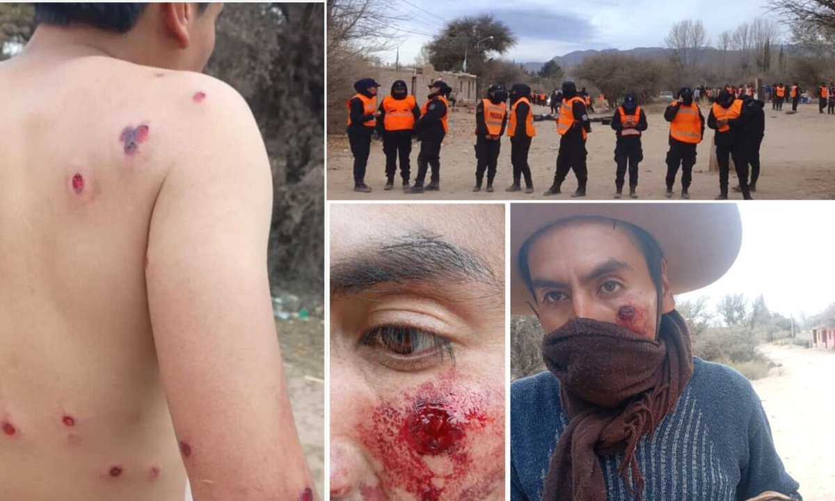 izquierdadiario's tweet photo. Libertad a los detenidos. Humahuaca: represión y violento desalojo de la policía de Sadir a familias indígenas.  En horas del medio día un fuerte operativo policial reprimió con balas de goma, disparando en la cara de miembros de la comunidad indígena de… https://t.co/KXNB3DD0da https://t.co/u3qlSfO1Gb