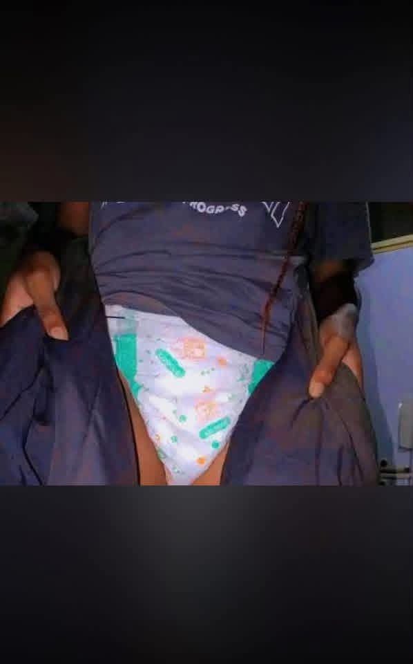 thegirlduru's tweet photo. I spent another day on a diaper because of contraceptives.
Today marks 2 years of me wearing diapers  because of the 2 months prevention injection shot I took at the clinic
 
Because of that my husband doesn't want to have anything to do with me again 😭 

And I did it because of him so he would not look out side or cheat

I bleed so heavily everyday in such a way that I can no longer use pads,but pampers instead. Dear ladies, rather have 2 babies every year than to use contraceptives. These things were never designed to help us, but to h@rm us. Let's all stop using contraceptives.

Shared to create awareness.

Copied from FB