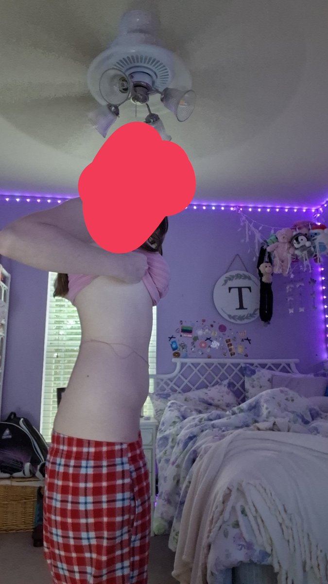 FulterShuu_2's tweet photo. Today's bc
My hipbones are coming into fruition 🥹 https://t.co/aicFfVaeOp