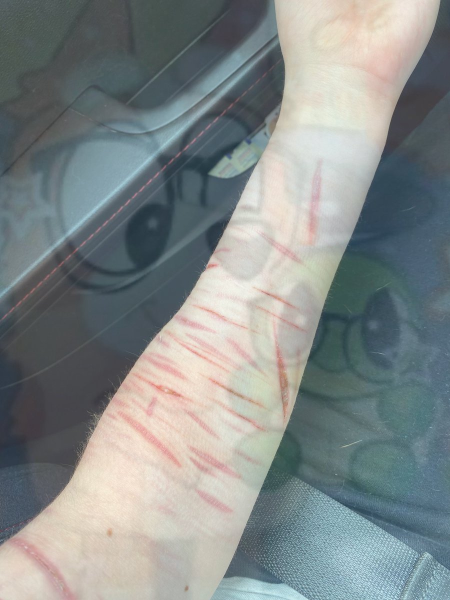 daybrrrr's tweet photo. why is my totally fake sfx makeup arm LUMPY? 
#988twt #slittwt SFXXXX AI https://t.co/EToHyJDkaz