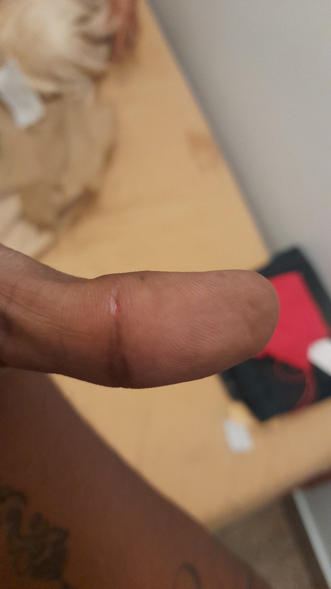Samit20lambu's tweet photo. @zomato please help!!! Paid 300 extra for delivery and taxes and convenience fees. I waited for 1 hpur for my food and its rotten!The chat support cant see the scrub item in my food! I am sooo furious! I cut my hand on the packaging that had an open staple pin as well. 8463438055 https://t.co/5QLYS0HkbN