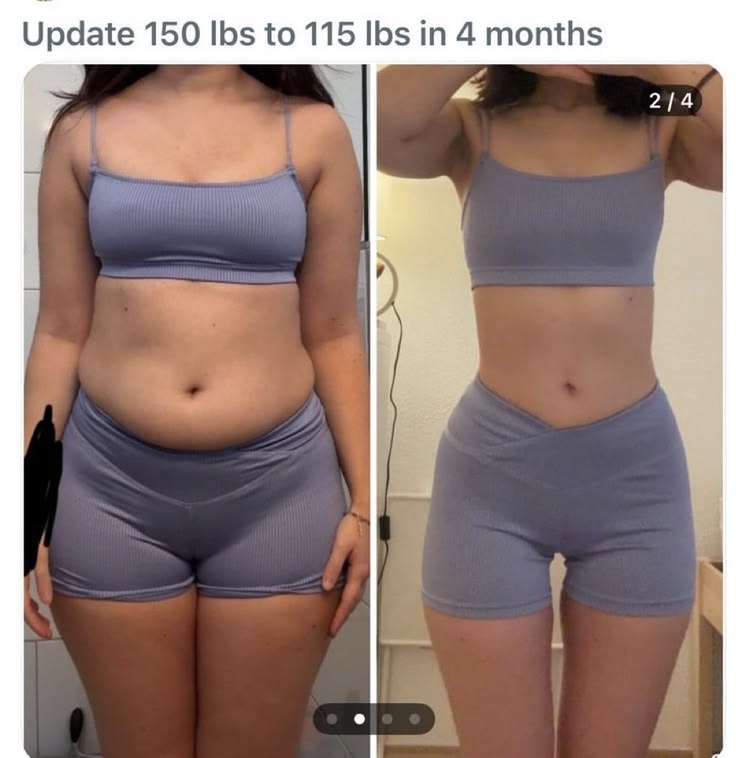 guitarrroad's tweet photo. I l0vee comparison of thin/fat bodies, especially if its wl of the same pers0n. Y0u can always see they dont regret losing weight! https://t.co/UdTyATxEhY