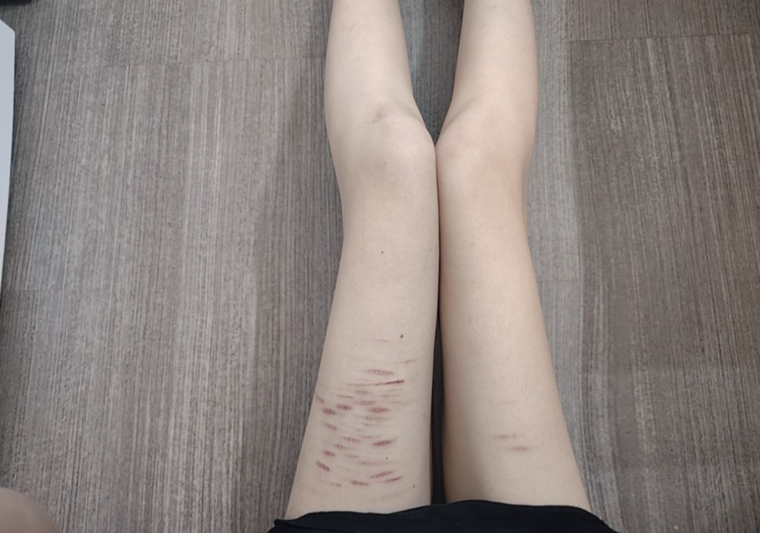 zenwhenwhat's tweet photo. YO MY SCARS ARE FADING WTF WTF WTF WTF WTF WTF Im fat And Ugly And Gross And Disgusting
#fatspo #shedtwt #edtwt https://t.co/1bEP2bZDC8