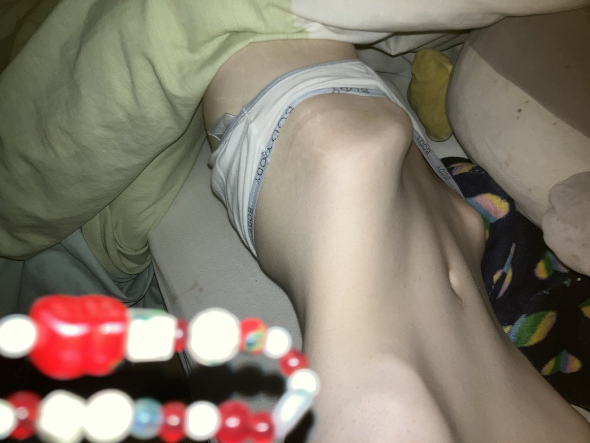 vxvuzez's tweet photo. I’m so fucking fat https://t.co/lUKuEBNreA