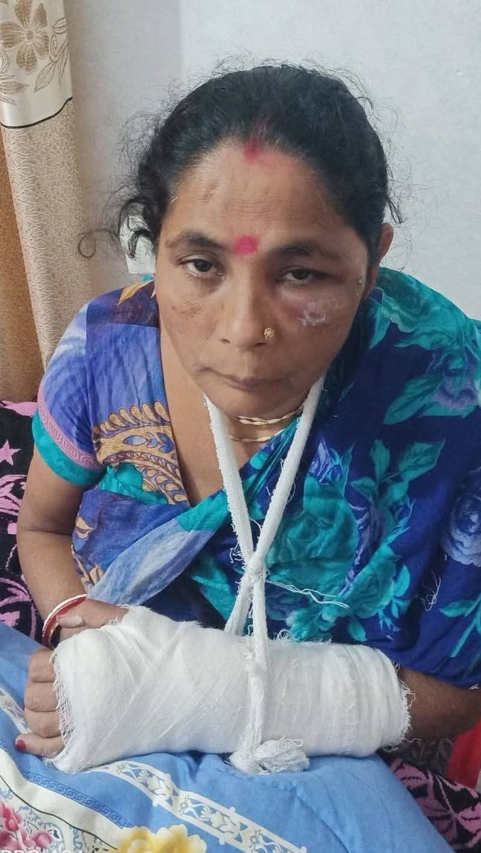 FarazPervaiz3's tweet photo. Bangladeshi Hindu family brutally attacked and robbed by Muslims. 

This happens to those Hindus who neither convert nor pay Jizya. https://t.co/v3mGODqOP2