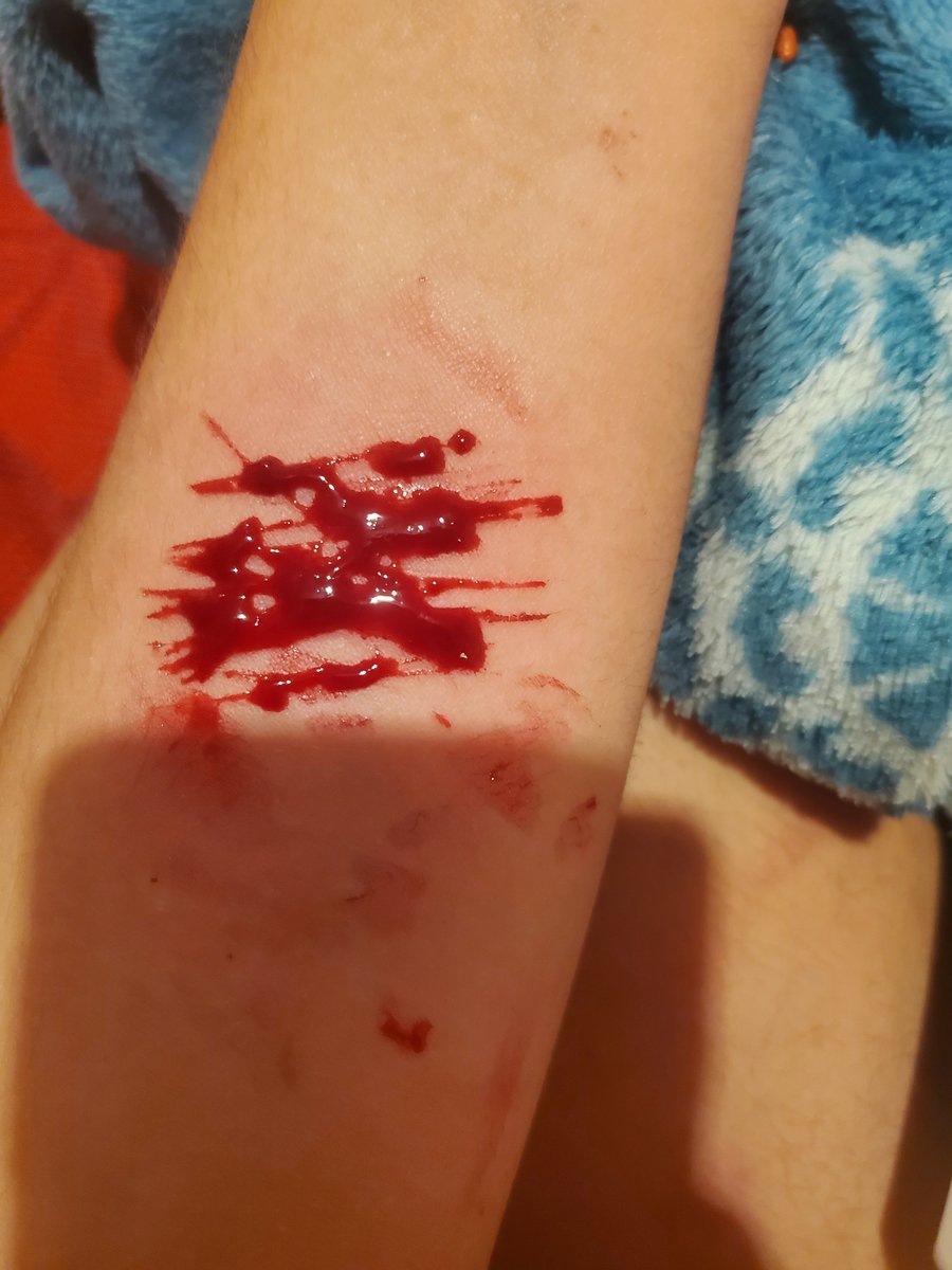 StarButter34431's tweet photo. #slashflashing fake halloween makeup ❤ https://t.co/WGHioEOJEk