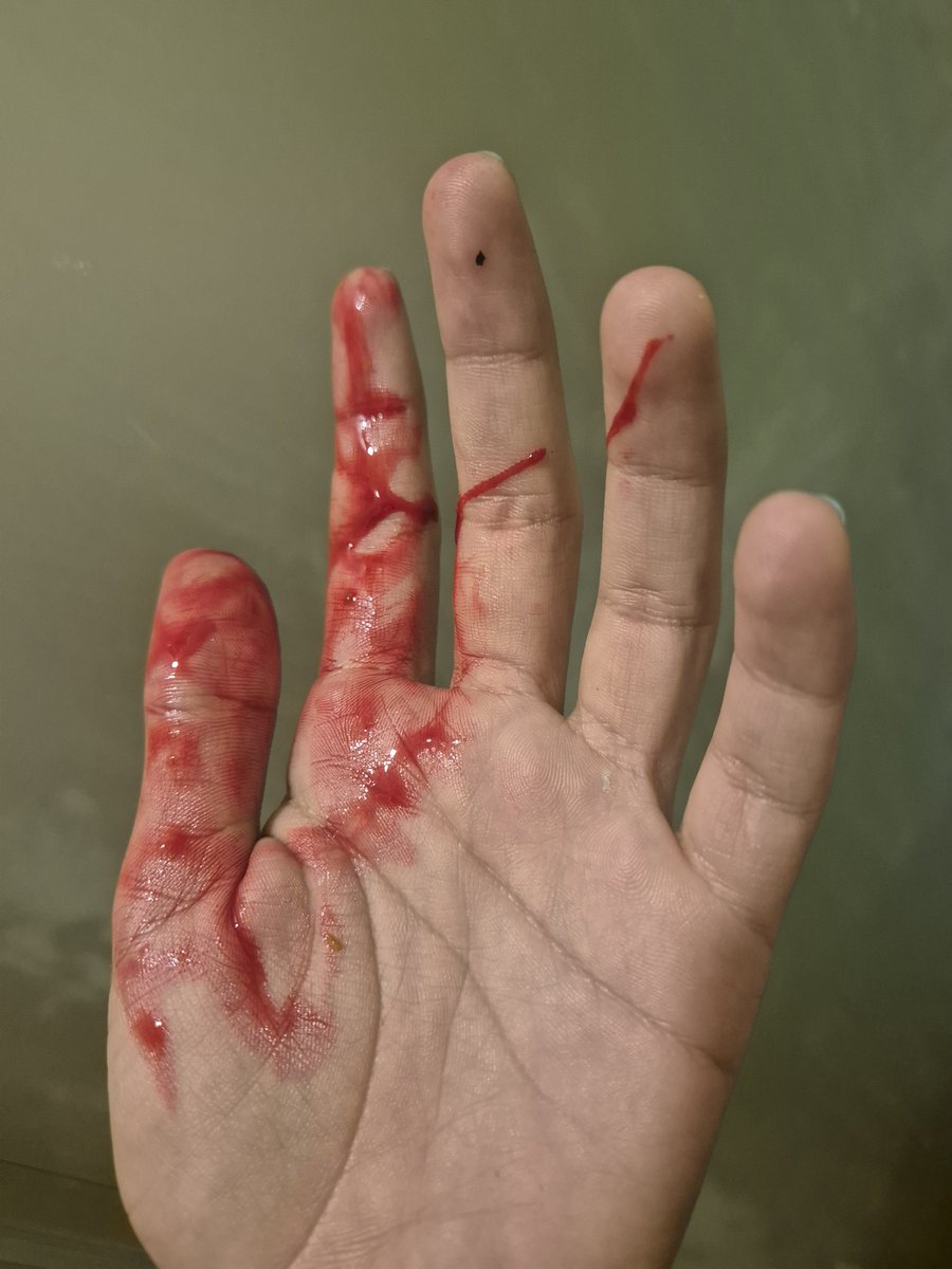 ChinaLimay's tweet photo. Estaba probando nuevos juguetes por el culo para hacer videos y creo que me lo rompí, debería ir al hospital o que hago? No dejo de sangrar 😭 https://t.co/A1EcMXJTHX