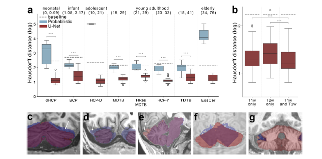ImagingNeurosci's tweet photo. New paper in Imaging Neuroscience by Yaping Wang, Jörn Diedrichsen, et al:

SUITPy: A Python-based toolbox for the analysis of cerebellar functional and anatomical imaging data across the human lifespan

https://t.co/1PutSthWy1 https://t.co/a7SABnSaNl