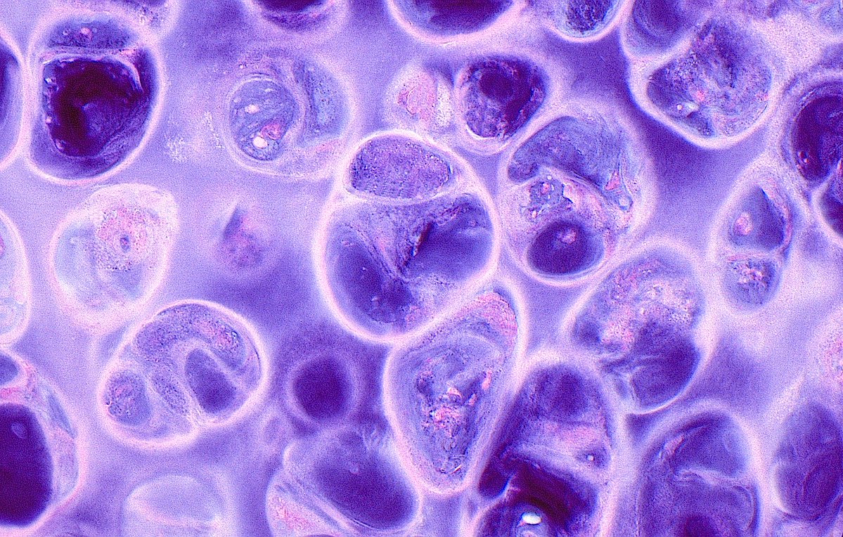 ziad_zaatari's tweet photo. π¬πΈ "Bold and Beautiful" ~ Hyaline Cartilage ~ #Pathology #Histology #BSTpath #PathArt π¨ https://t.co/AFH3BGuRCL