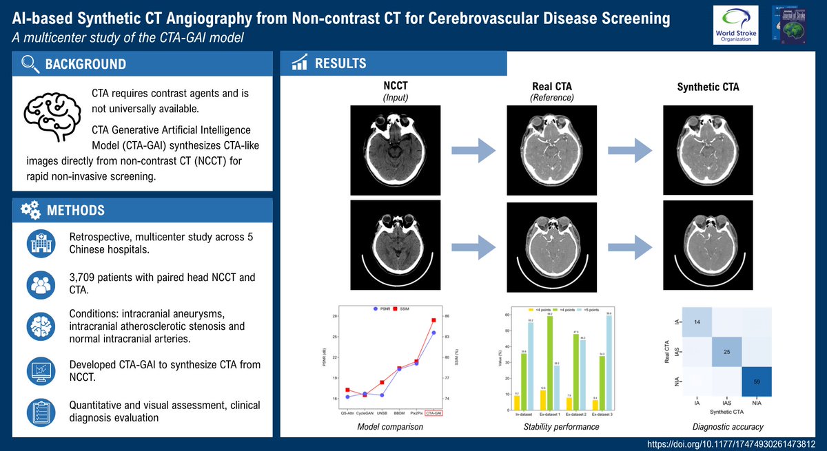 IntJStroke's tweet photo. 🖥️🧠AI-generated CTA from routine non-contrast CT achieved >92% accuracy for cerebrovascular disease screening in 3,709 patients

💡Offers a fast, low-cost, contrast-free tool for triage

Read the article here👇
https://t.co/pq3vZ4gxr5 https://t.co/bqpvzKzcU3