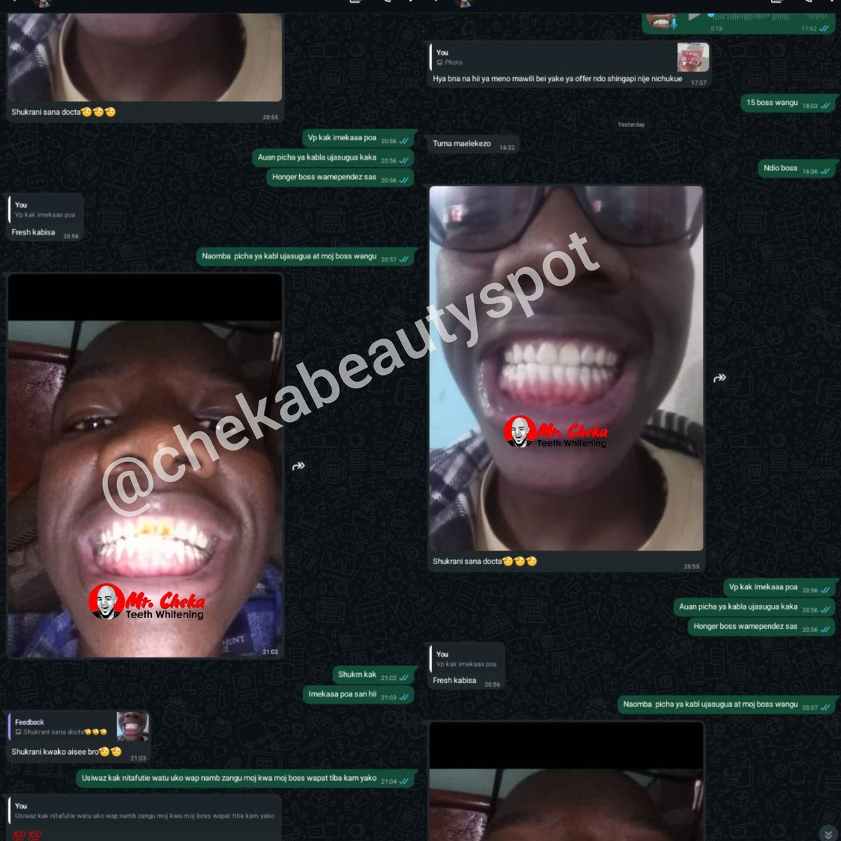 chekabeautyspot's tweet photo. Feedback kutoka kwa mteja wetu aliyetumia Dawa ya Mr cheka instant whitening solution Kusafisha Meno yake... karibu cheka beauty spot kwa huduma yenye MATOKEO ya Uhakika 🔥 Agiza Dawa yako Sasa... https://t.co/HMzSlYdBBy