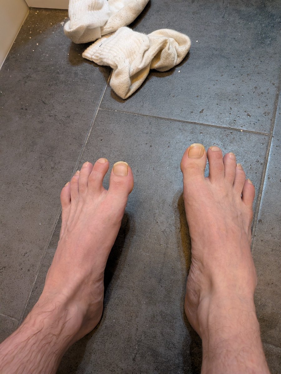 cash_peda's tweet photo. Heute ist Erntetag, du Faggy.😂

Es ist deine Möglichkeit mir meine ekligen Zehennägel abzukaufen. 🤢
Ich weiß ja, dass du Homoloser drauf stehst, kannst dir gleich die Socken auch noch dazugönnen. Für sowas zu zahlen passt echt gut zu dir. 💀
#findom #cashpig #finsub #humanatm https://t.co/f7v5dyiguF