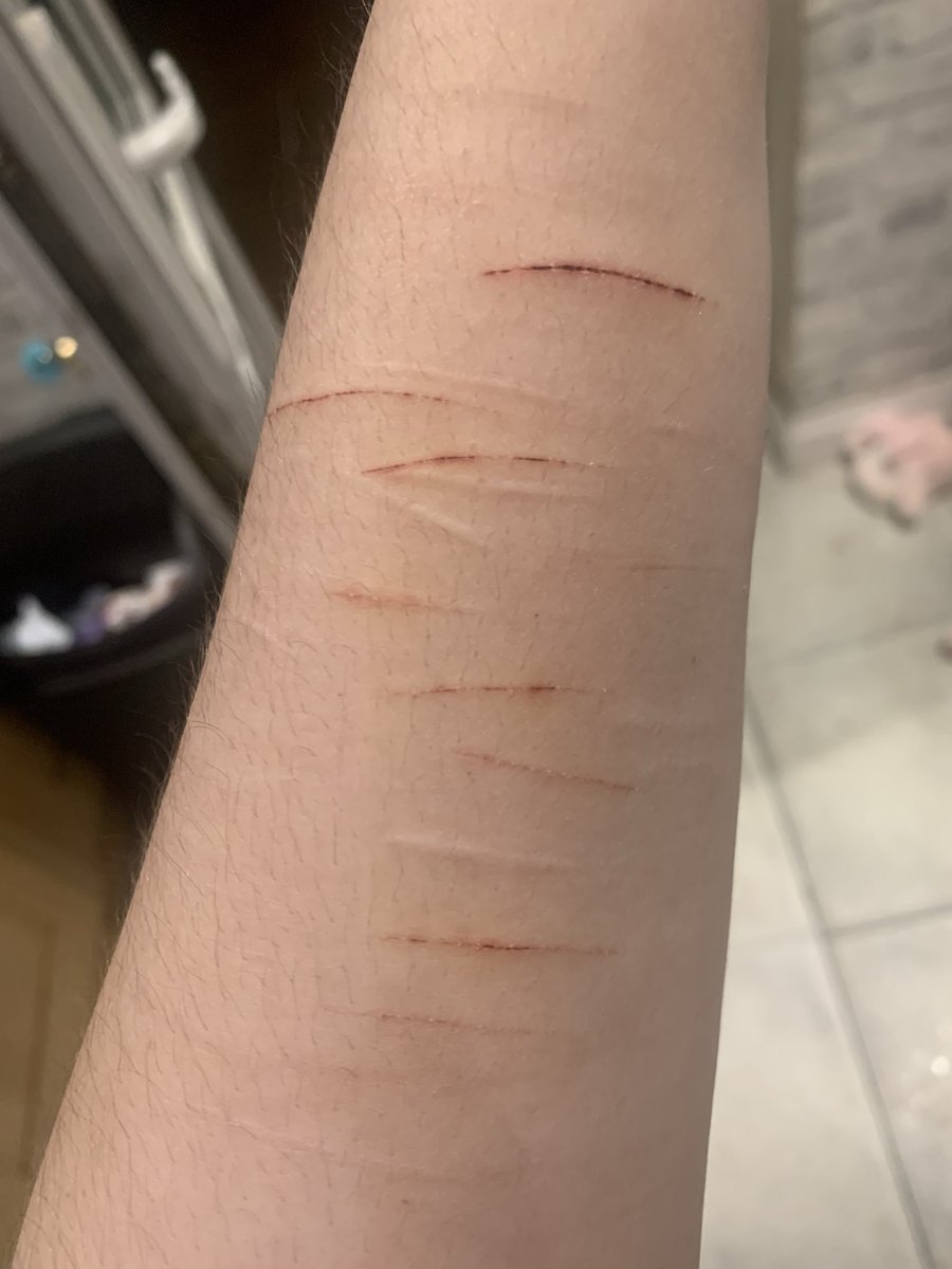 gentlemoominz's tweet photo. do u guys think these will be healed in 2 weeks time... 😓😓 https://t.co/FFeGRVxLog