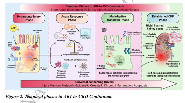 JasmineNephro's tweet photo. AKI → CKD: How does it happen? 🫘🩺

https://t.co/d1yDojogKl

@NDTsocial https://t.co/tOBMUl9D4b