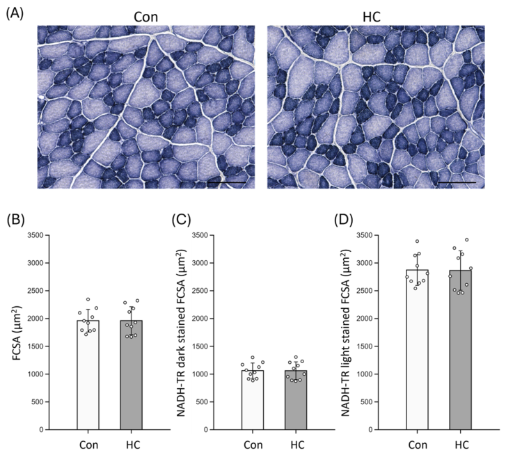 Muscles_MDPI's tweet photo. 🌍⚡ Research Alert🌱💡
📄 Title: Histomorphological  Effects of Repeated Administration of the TRPA1 Antagonist HC-030031 on  Intrafusal and Extrafusal Muscle Fibers in Healthy Young Rats
🔗 Read it here:https://t.co/aNq0KG3Z6N

#musclespindle #skeletalmuscle https://t.co/DfyN3LVVSM