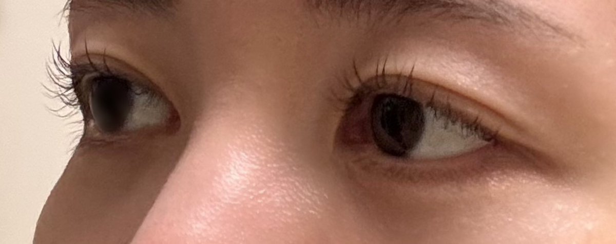 piyobiyou's tweet photo. DT2ヶ月
馴染んでて自分的にはいい感じ。このまま残ってくれると嬉しい。 https://t.co/8oLfl2djYL