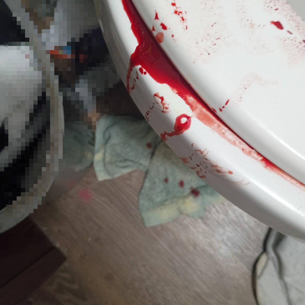 _chubbybunnii's tweet photo. The things they don't tell you about sh🫩

+My thigh is stiff with medical tape and bandages https://t.co/BQFq8c0rKM