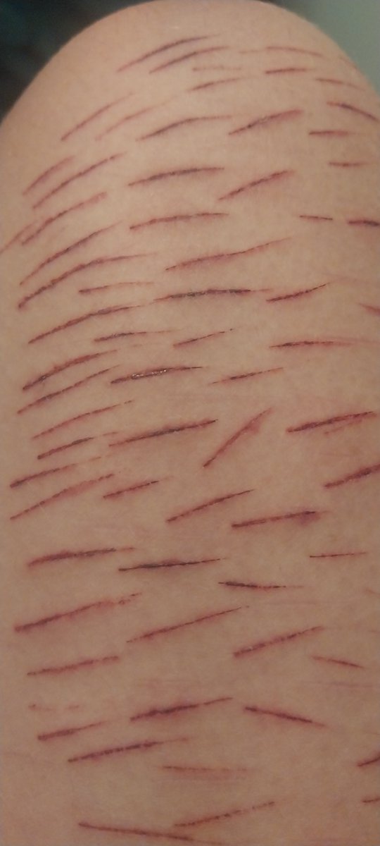 butcher2hl's tweet photo. Would you believe me if i said it was my cat

Yes its fake
Yes its sfx makeup
Yes its ai generate
Tw for senesitive eyes realistic makeup https://t.co/PxteIKZ0k9