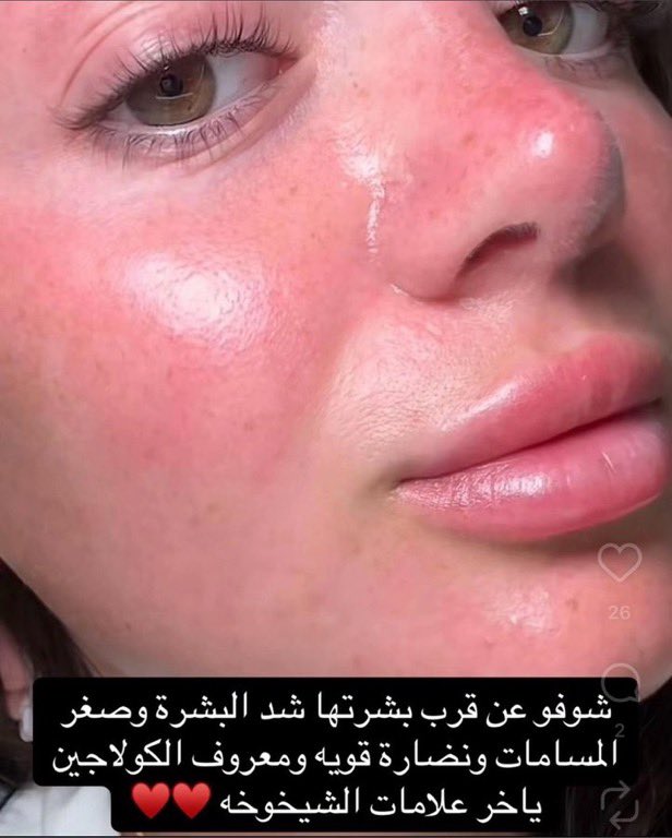 HasmHasmesih's tweet photo. شفتوا الماسك اللي انشهر من هايلي بيبر ويعطي منظر البشرة الزجاجية؟ 🪞🪩
الماسك حلو و مفعوله افضل من باقي الماسكات لان مكوناته عبارة عن كولاجين وفيتامينات تفيييييد بشرتك و لازم تحطيه طووول الليل يعني طول ما انتي نايمه بشرتك تستفيد من الماسك مو دقايق وتغسلينه زي باقي الماسكات https://t.co/jt3Xmae4iJ