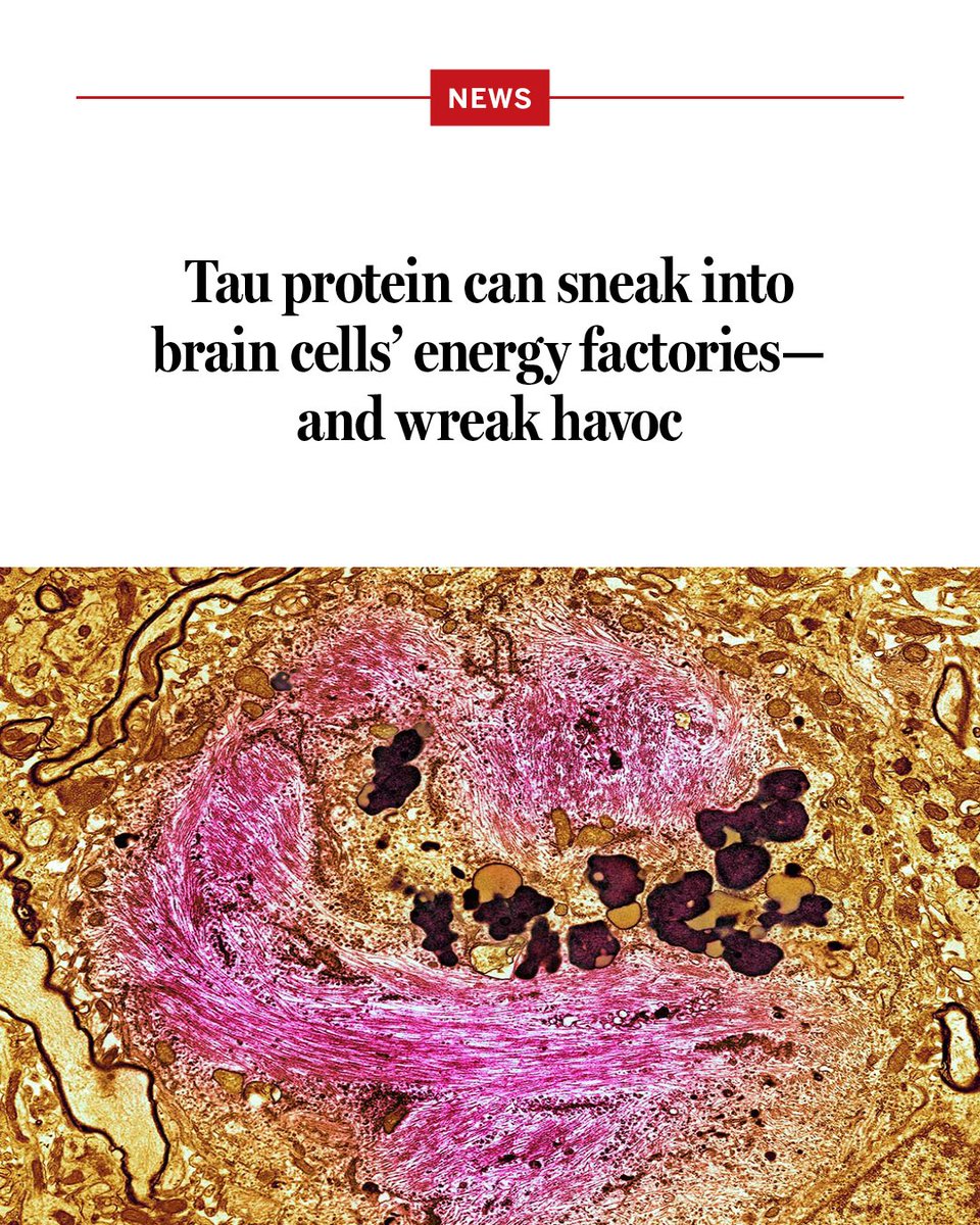 NewsfromScience's tweet photo. The protein tau is best known for its potential to clog the brain. In neurodegenerative conditions including Alzheimer’s disease, chains of the molecule twist into tangles inside neurons and choke out the cells. 

But a new study suggests tau may play an earlier and more fundamental role in neurodegeneration: sneaking into the cell’s power-generating mitochondria—the cell’s power generators—and interfering with aging neurons’ energy production. 

If this process gets out of control, it creates tangle-prone forms of tau and other toxic byproducts that damage neurons, long before a person’s cognitive symptoms start.

Learn more: https://t.co/2Vaa2RuNnS