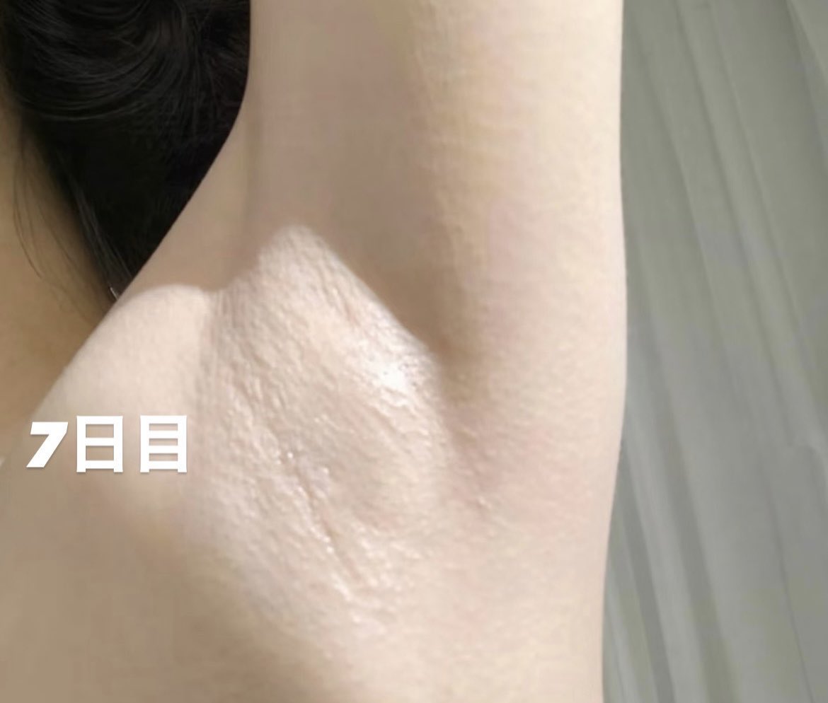 Rio_biyo's tweet photo. １週間使ってコリです。全身の黒ずみが徐々に白くなる。 https://t.co/W0C9vusssq