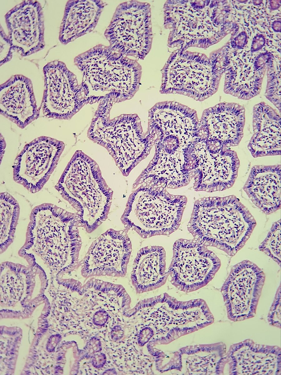 megha_lalcheta's tweet photo. Prettiest jigsaw 🧩 

#GIPath Colonic mucosa.

#Pathology #PathX #Pathologists #PathResidents #SurgPath https://t.co/RmXpwX7kcQ