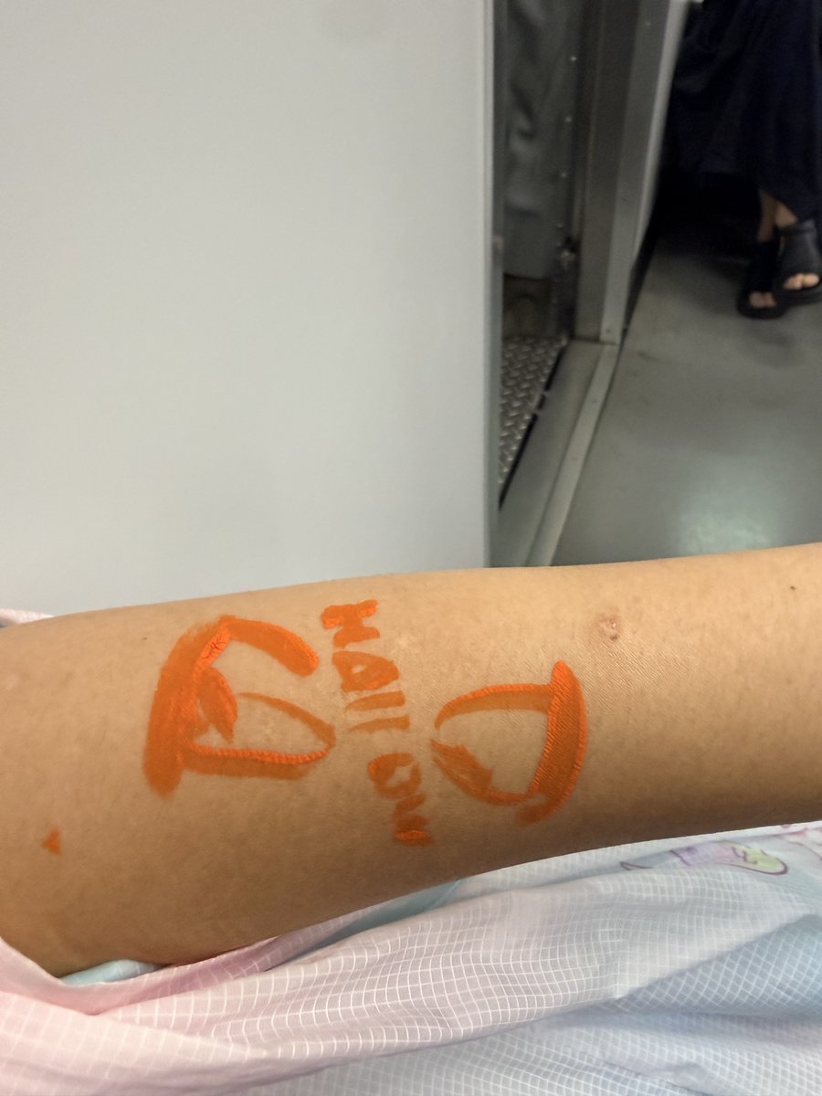 Umichan_rena's tweet photo. なんか瀬戸さんに落書きされました。お揃いらしいです。推しに似てあかおかさんなのでこのまま電車乗りました https://t.co/a6JJSIZqHI