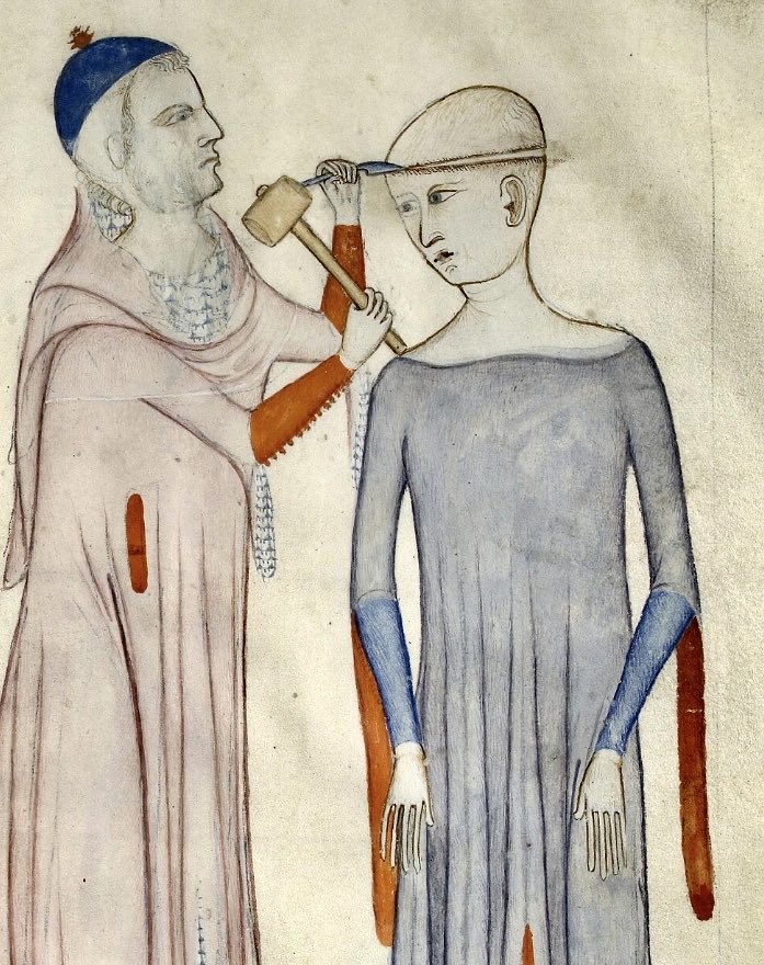 DamienKempf's tweet photo. How to cure a migraine - the medieval way https://t.co/sAsDmw0cMe