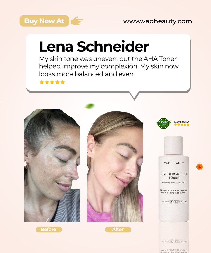 vaobeauty's tweet photo. Dull skin, Rough Texture, Pores and Uneven skin tone fades and get erased when apply daily. 

Buy now on https://t.co/hc8a8uHxUw

#DullSkin #roughtexture #pores #unevenskintone https://t.co/0hyMgL3Jmr