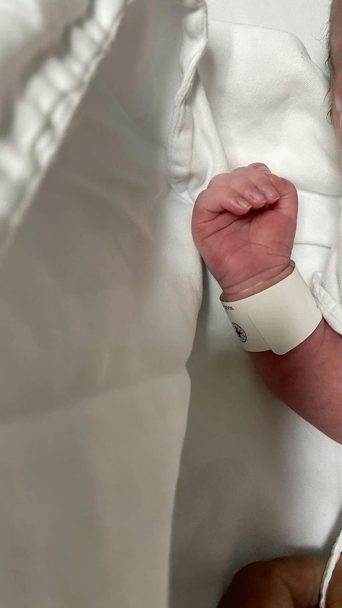 kasamasa0's tweet photo. Did you know that❓️#Day50 🎉
A newborn aged 0–3 months generally needs around 14–17 hours of sleep per day.
#Newborns #MedX https://t.co/X2C3aH5iUj