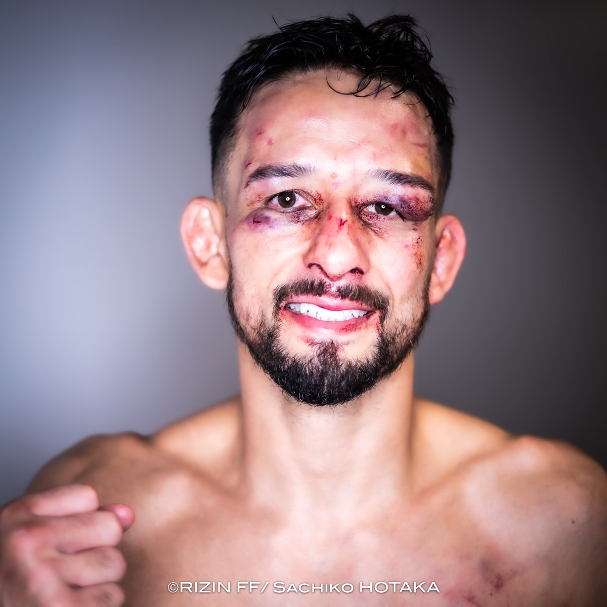 greco_free's tweet photo. 【#クレベル・コイケ  🇧🇷 @KoikeKleber 】
#RIZINの漢たち -闘いのあと-

#RIZIN54
2026年8月11日(火祝)
TOYOTA ARENA TOKYO https://t.co/gBtiehKI5l