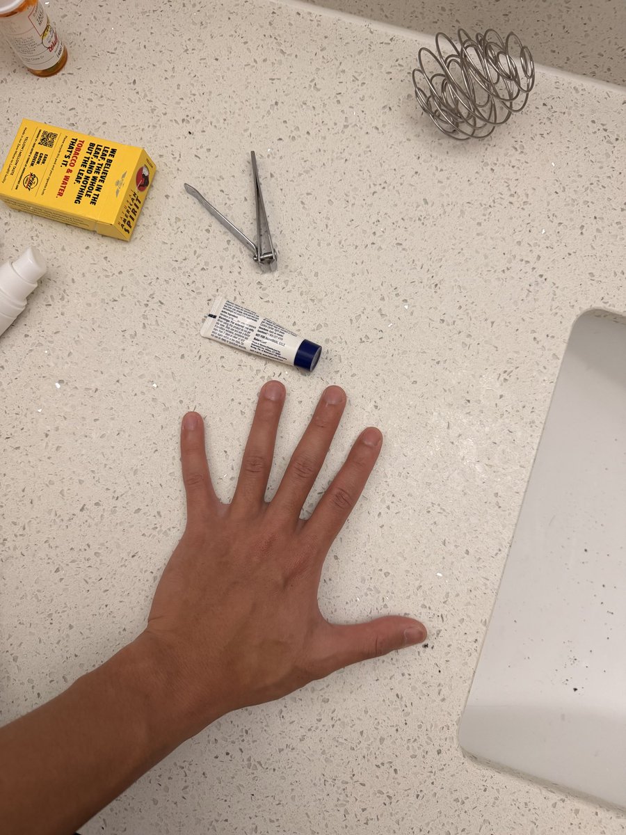 GenghisJawnson's tweet photo. You ever cut your nails too short? What do you do? Am I doing this shit right? https://t.co/7zQopfTfLQ