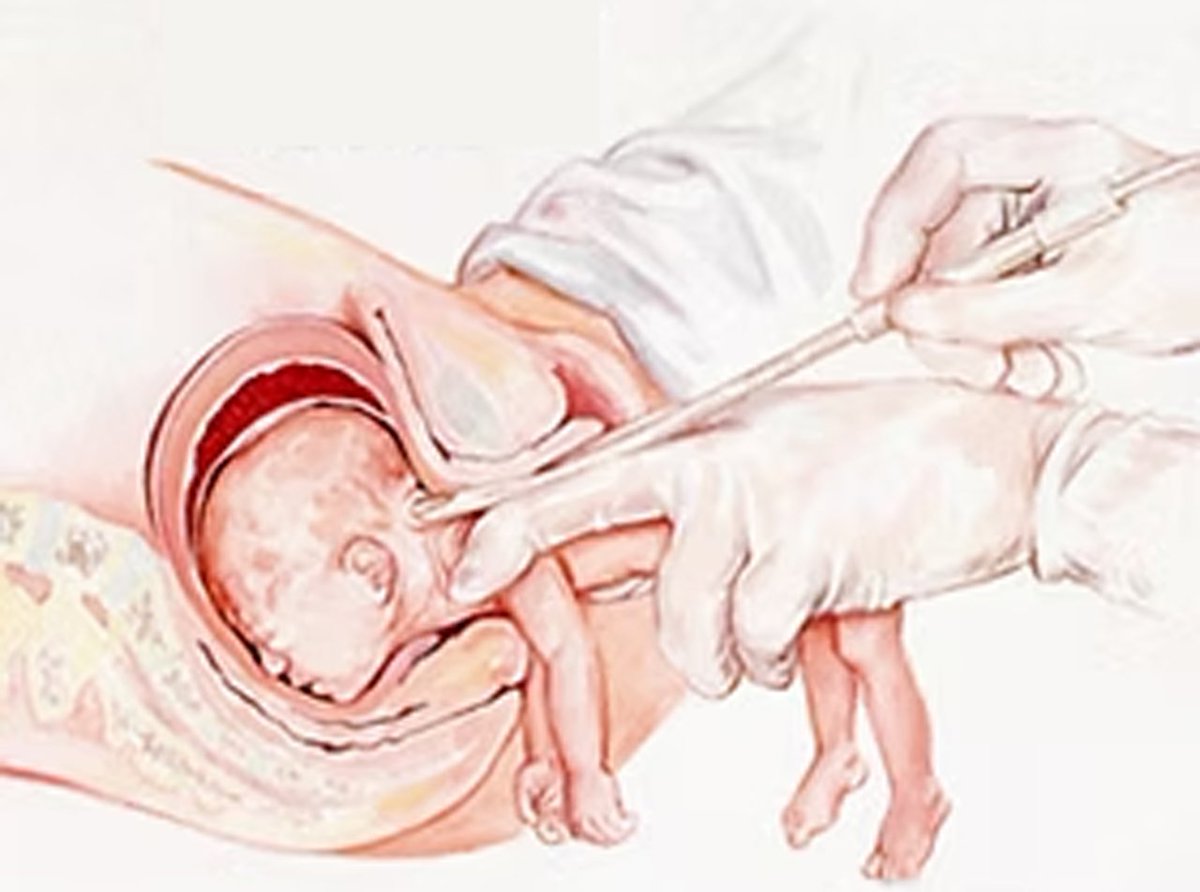 the_christnats's tweet photo. The following 10 American States allow abortion up to birth:

Alaska 
Colorado 
Maryland 
Massachusetts 
Michigan 
Minnesota 
New Jersey 
New Mexico 
Oregon 
Vermont 

As well as Washington, D.C.

This is a monstrous evil. https://t.co/hQc5AVEVRj