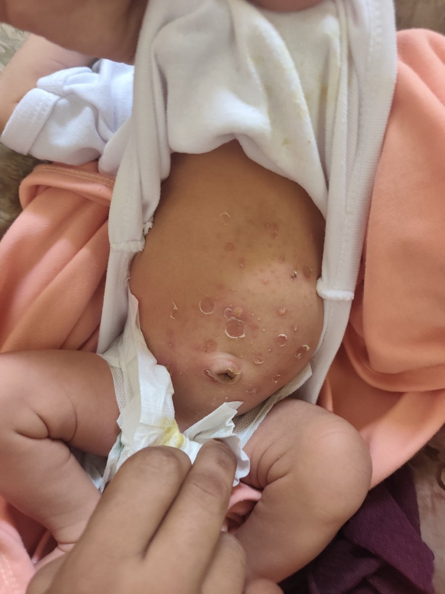 Nabhan0ab55's tweet photo. My heart aches for my child 🍼

︎
︎

︎

︎

︎

︎
︎

︎

︎

︎

we’ll remind you
︎

︎

︎

︎

︎
︎

︎

︎

︎

︎
︎

︎
︎

︎
︎

︎

︎

︎

︎
︎

︎

︎
that
︎

︎

︎

︎

︎

︎
︎

︎

︎

︎

I desperately need TREATMENT for my baby.
https://t.co/oL4AWhipaT https://t.co/Uui9AMX3I8